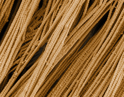 microscopic view of collagen fibers