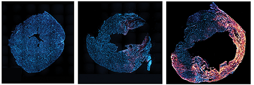 3Helix's fluorescent probe can detect the progression of damage caused to the tissue surrounding the heart after three days (middle) and seven days (right) after a heart attack compared to a normal sample (left) by revealing the amount of damaged collagen.