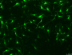 Nerve Cells Displaying Florescent Sensors